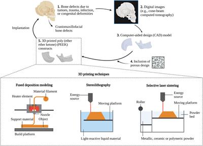 Research progress of 3D printed poly (ether ether ketone) in the reconstruction of craniomaxillofacial bone defects